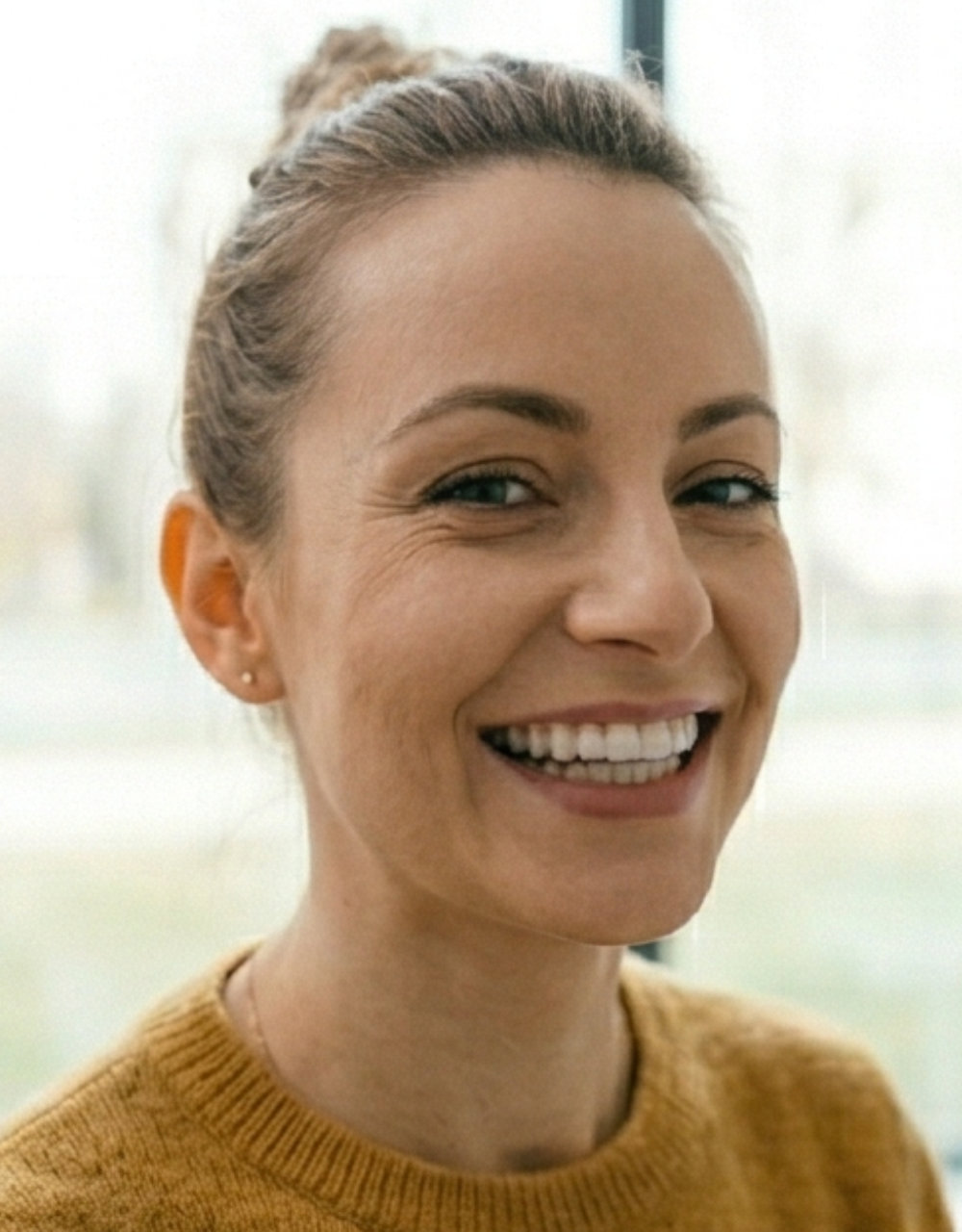 Efekt leczenia Invisalign® Bydgoszcz