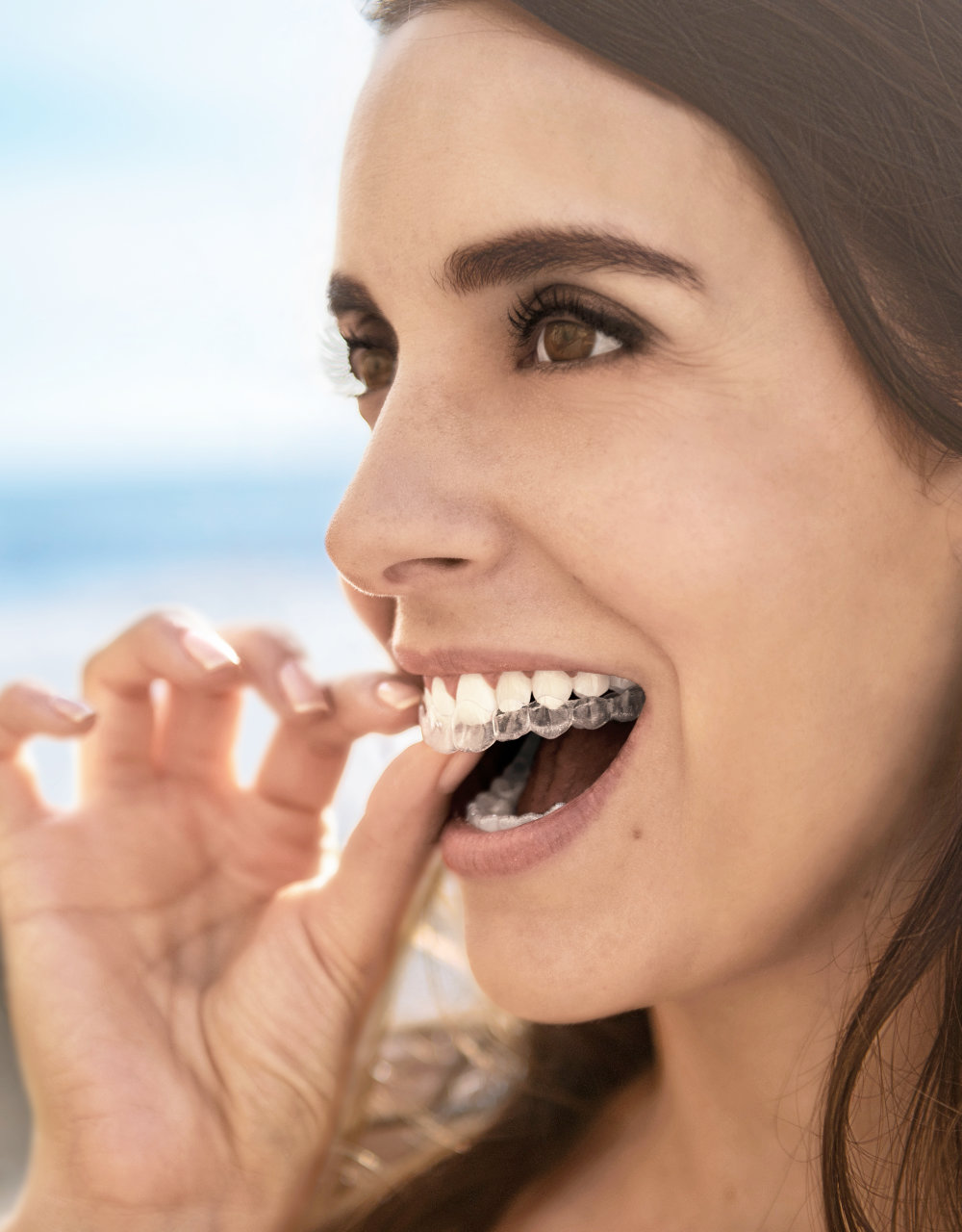 Niewidoczne nakładki Invisalign® Bydgoszcz