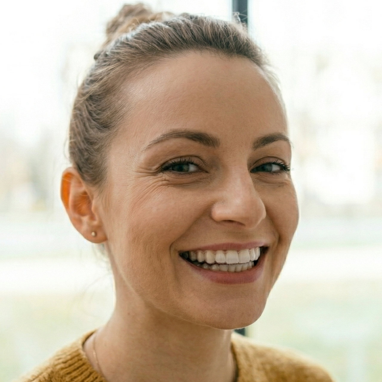 Invisalign® krok 4 Bydgoszcz